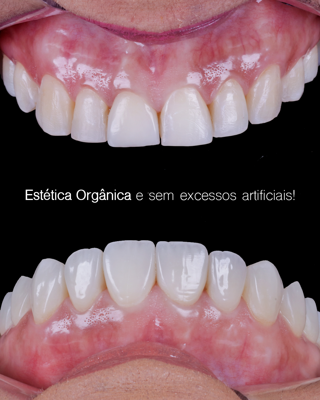 MONTAGEM-8